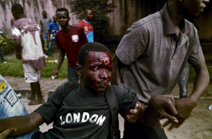 An injured supporter of the main Congolese opposition party UDPS in Kinshasa on March 28 (Reuters/Robert Carrubba)
